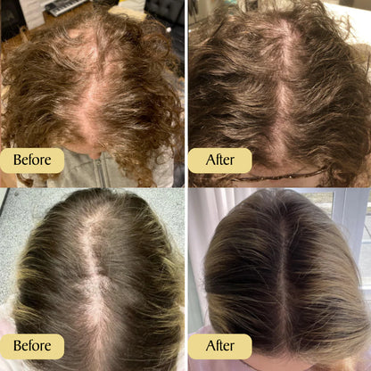 🔥BUY 1 GET 2 FREE🔥 Vegan Hair Growth Oil - Low in Stock