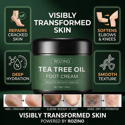 Rozino Tea Tree Oil Foot Cream | Vitamin E, Aloe Vera & Peppermint | Repairs Cracked Heels, Rough Elbows & Dry Knees | Intense Hydration