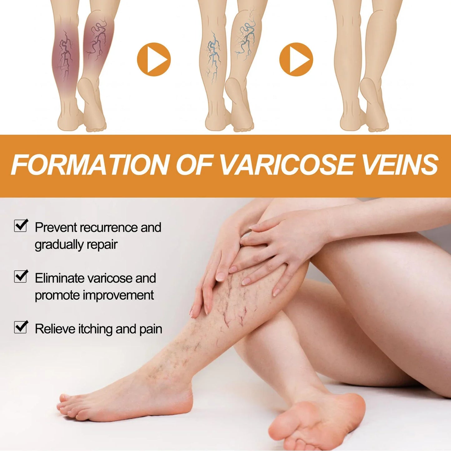 Turmeric Varicose Vein Relief 🔥 BUY 1 GET 2 FREE 🔥