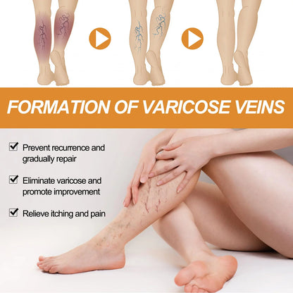 Turmeric Varicose Vein Relief 🔥 BUY 1 GET 2 FREE 🔥