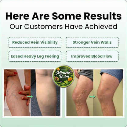 Senzio Miracle Balm™ 🔥 BUY 1 GET 1 FREE