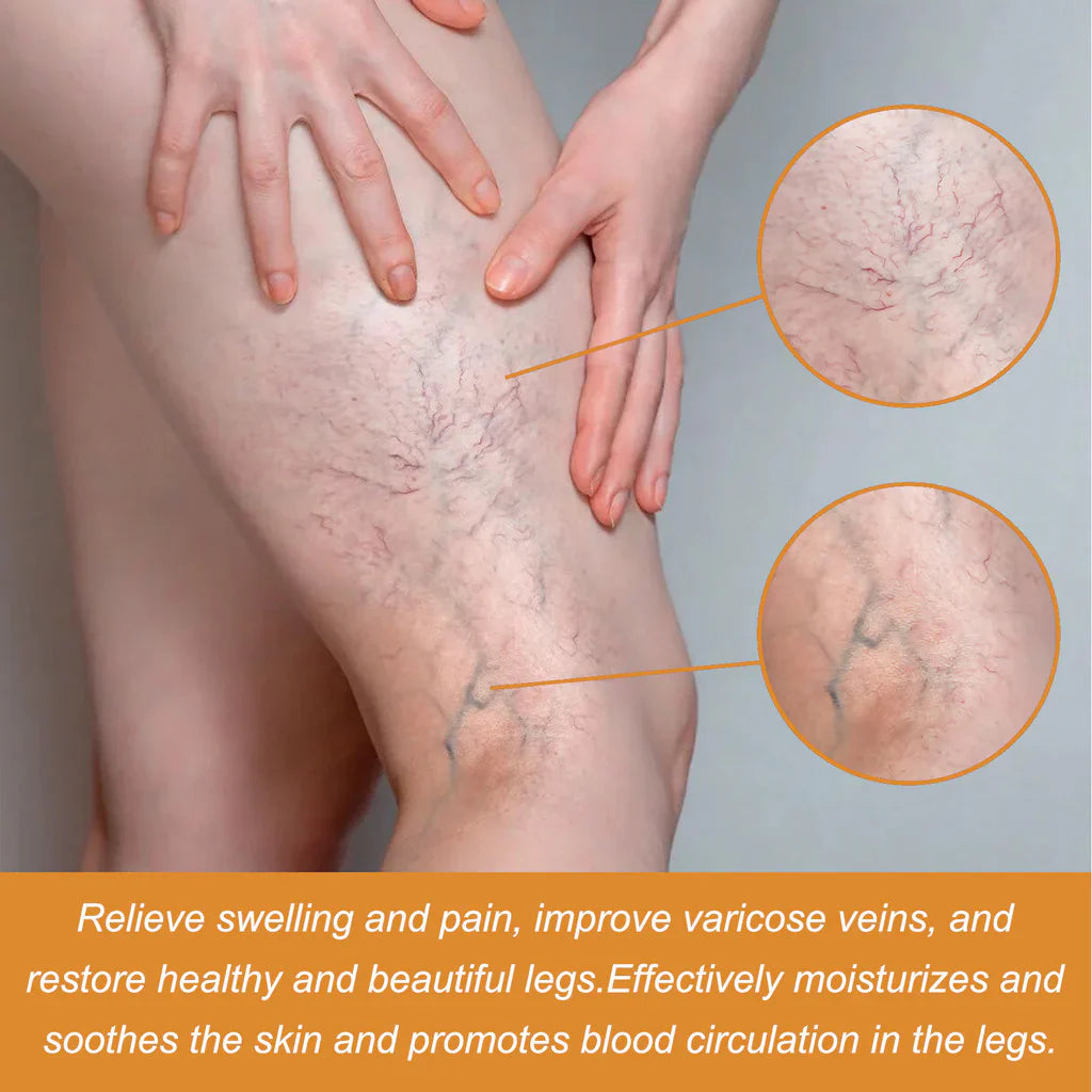 Turmeric Varicose Vein Relief 🔥 BUY 1 GET 2 FREE 🔥
